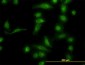 AKR1B10 Antibody (clone 1A6)